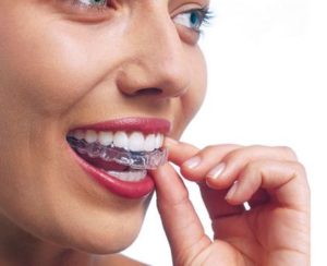 invisalign®