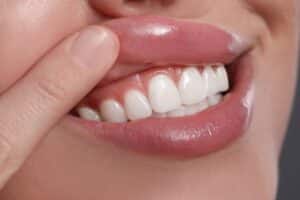 Woman lifts her lips to show off healthy, pink gums.